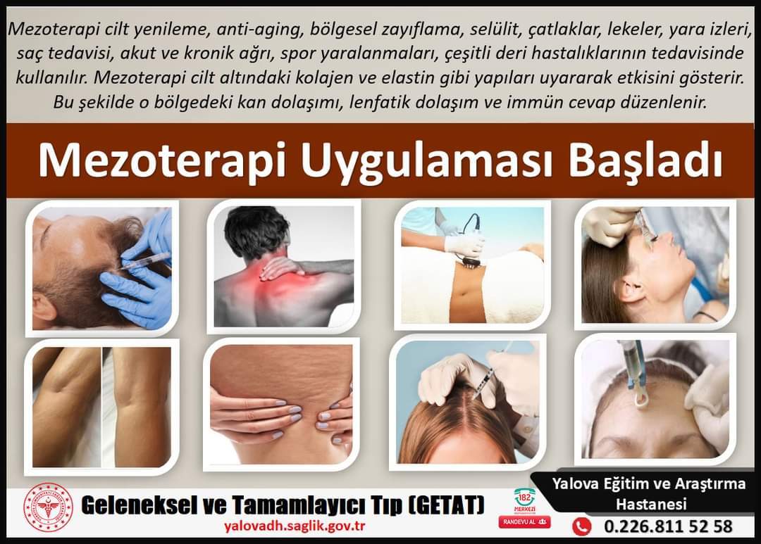 YALOVA EĞİTİM VE ARAŞTIRMA HASTANESİNDE MEZOTERAPİ BAŞLADI